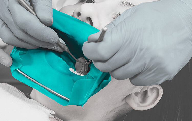 探索 100% 可回收的TPE材料在牙科隔離障中的應用