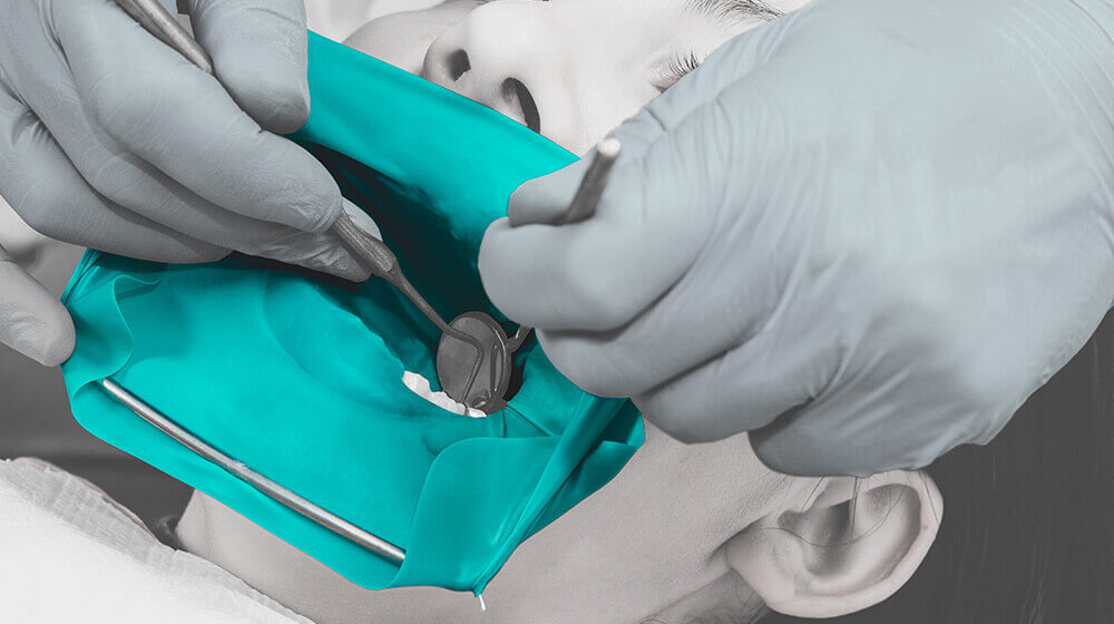 Exploring the Use of 100% Recyclable TPE Material in Dental Dam Applications